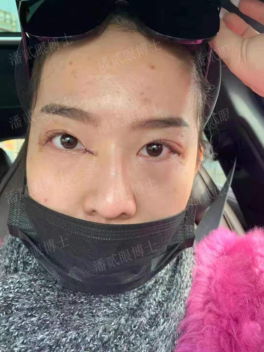 这些姿势做多了小心变丑又伤身