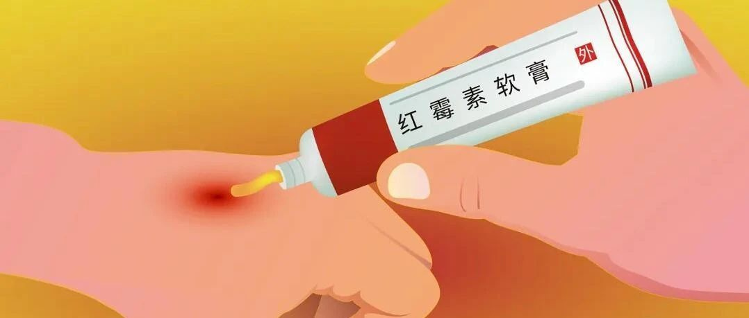 红霉素软膏与眼膏的区别解析