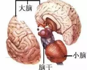 医生说脑干出血必死，真相、误区与应对