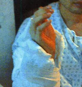 女子转身与男子相撞摔骨折获赔7万，一起意外事件引发的深思