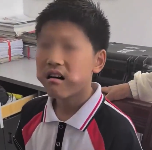 三角尺的尴尬遭遇，嘴中被卡的惊险瞬间