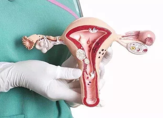 女子切除子宫有什么危害