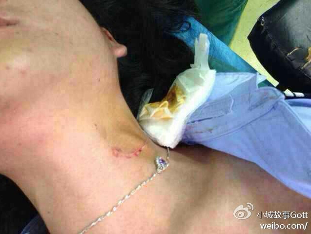 震惊！145人遭遇注射器意外刺伤事件深度解析